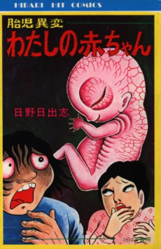 胎児異変 わたしの赤ちゃん