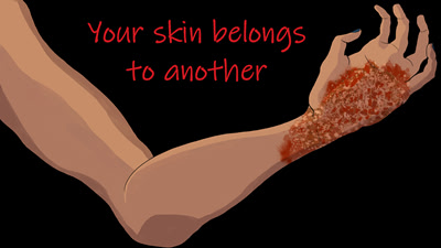Your skin belongs to another